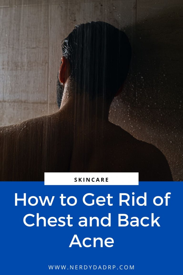 How to Get Rid of Chest and Back Acne